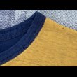 小さなシミ汚れ